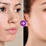 How Does an AI Skin Enhancer Work? A Step-by-Step Guide